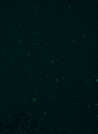 Time-lapse fluorescence microscopy of BIN1-induced membrane tubulation